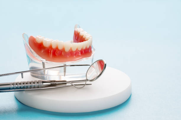 Full Mouth Reconstruction in Lower Grand Lagoon, FL