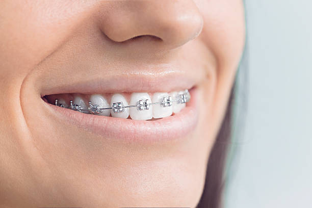 Best Teeth Whitening  in Lower Grand Lagoon, FL